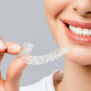 invisible braces in Islamabad