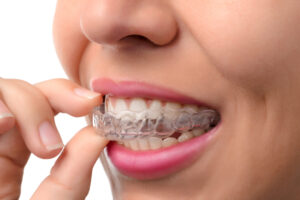 teeth aligners in islamabad